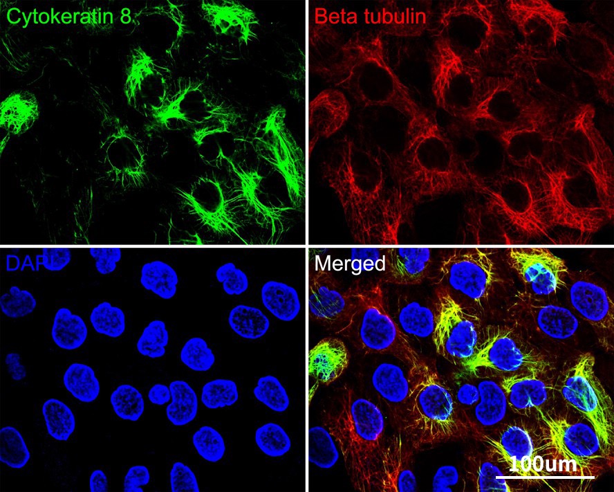 Cytokeratin 8 Recombinant Rabbit Monoclonal Antibody [SU0338]