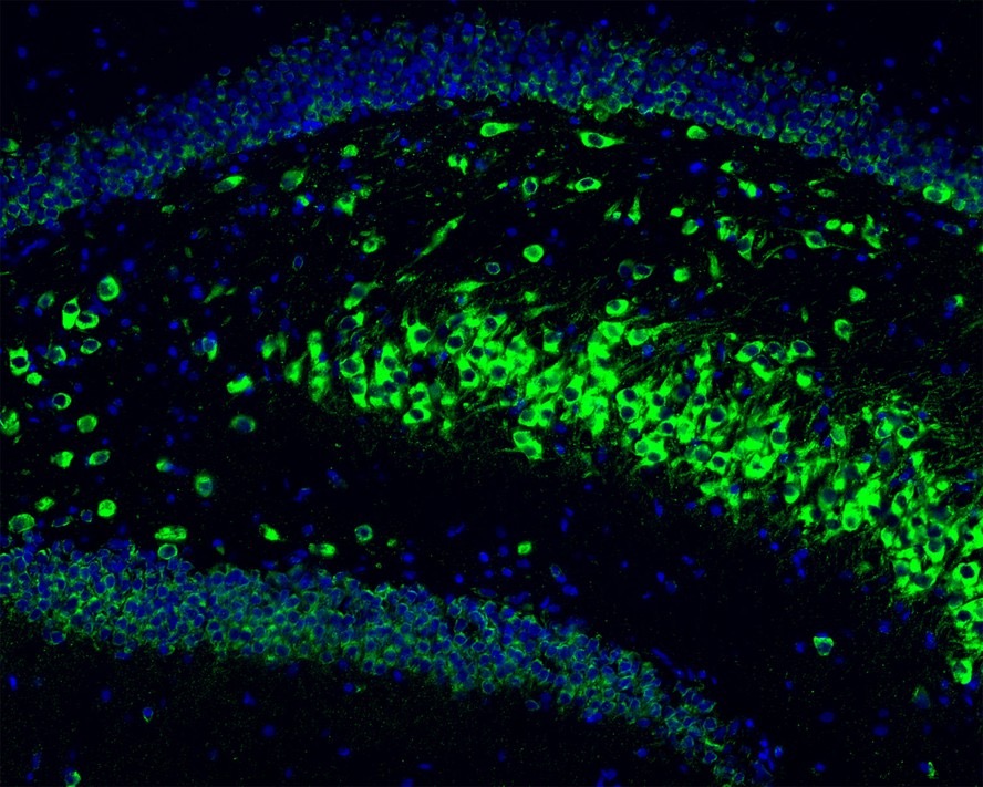 Phospho-Tau (T231) Recombinant Rabbit Monoclonal Antibody [SC58-08]