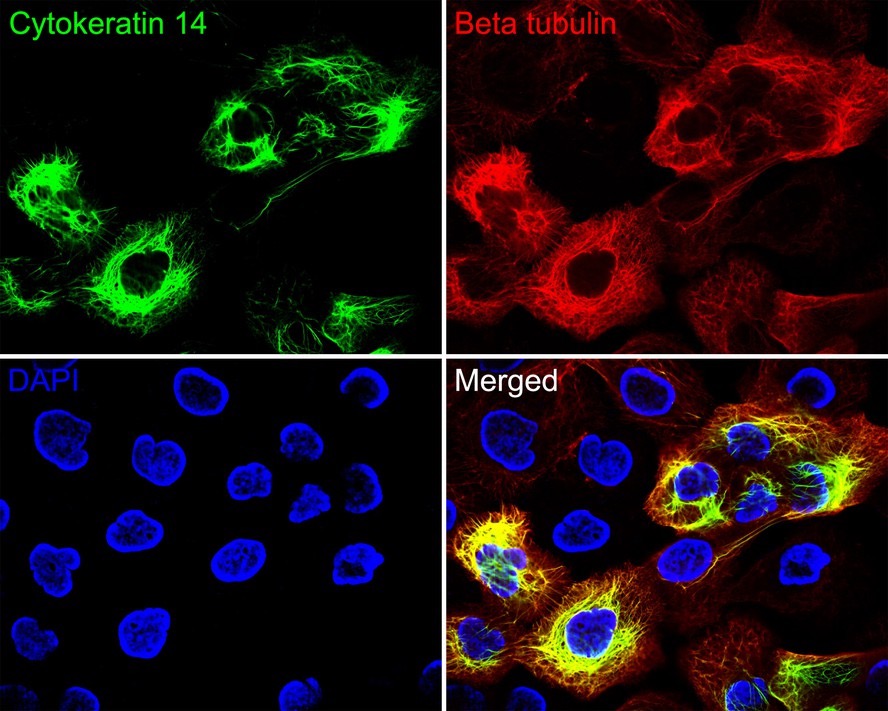 Cytokeratin 14 Recombinant Rabbit Monoclonal Antibody [SC65-06]
