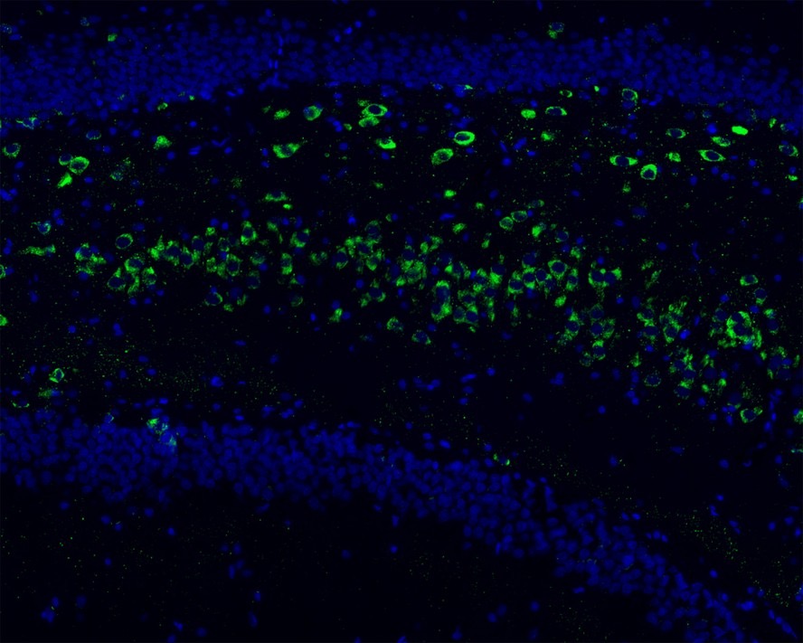 Phospho-Tau (S396) Recombinant Rabbit Monoclonal Antibody [SN62-09]