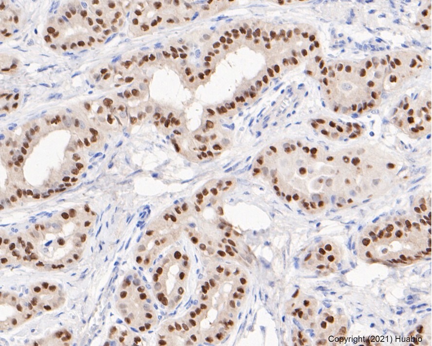 PAX8 Recombinant Rabbit Monoclonal Antibody [JJ08-88]