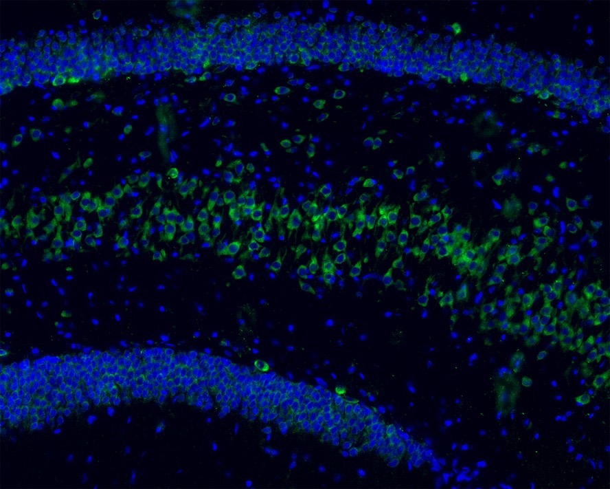 Huntingtin Recombinant Rabbit Monoclonal Antibody [JB89-34]