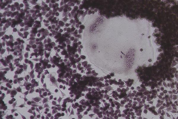 Mouse TRANCE/RANK L/TNFSF11, C-Strep II (Active) Protein