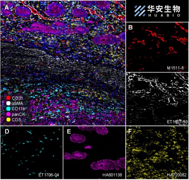 pan Cytokeratin Recombinant Mouse Monoclonal Antibody [PDH09-10]