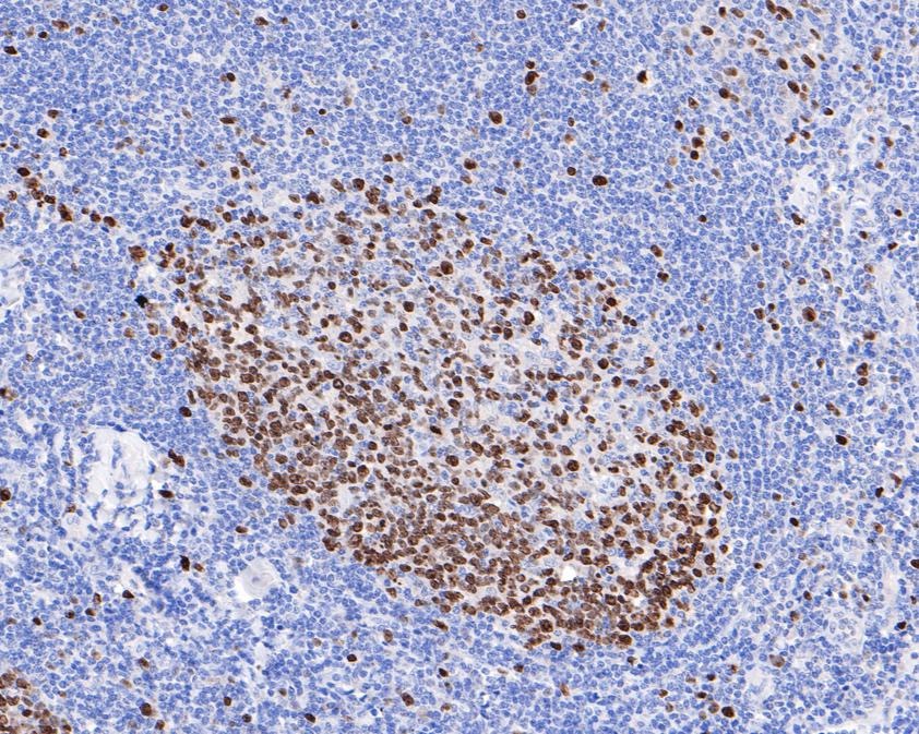 Ki67 Recombinant Rabbit Monoclonal Antibody [SR00-02]