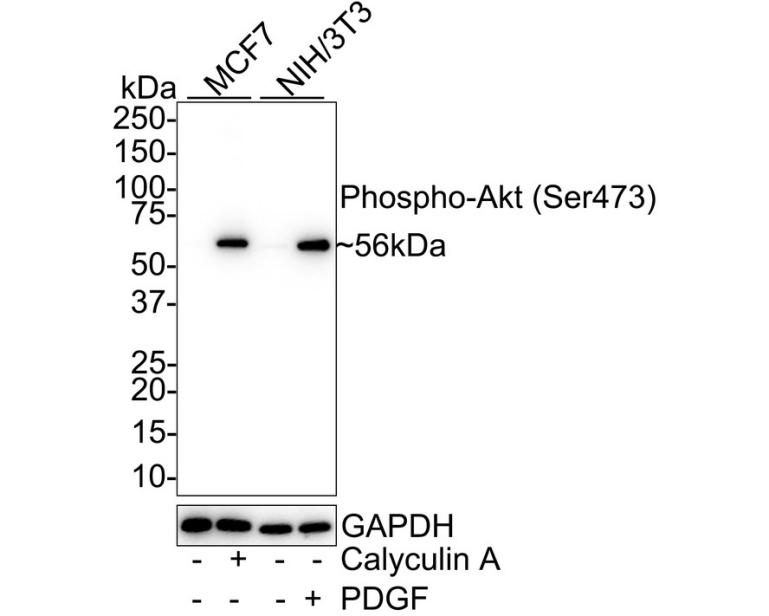 Phospho-AKT (S473) Recombinant Rabbit Monoclonal Antibody