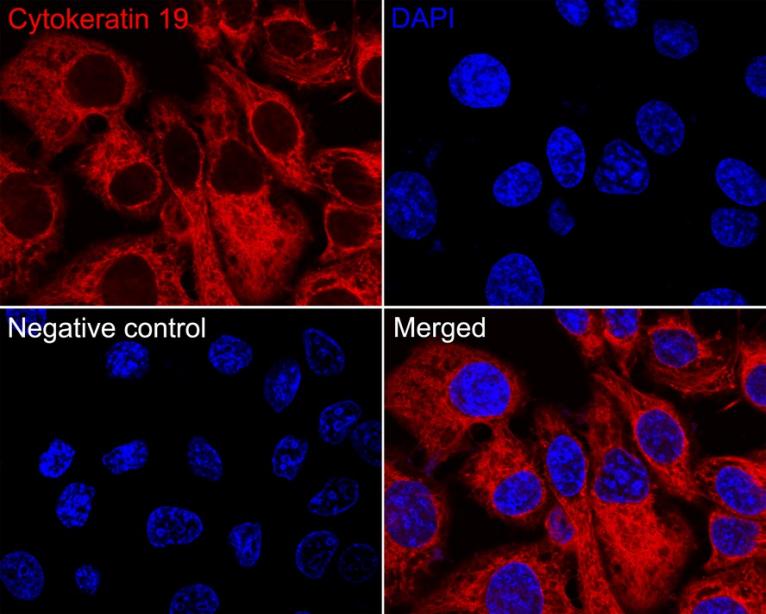 iFluor™ 594 Conjugated Cytokeratin 19 Recombinant Rabbit Monoclonal Antibody