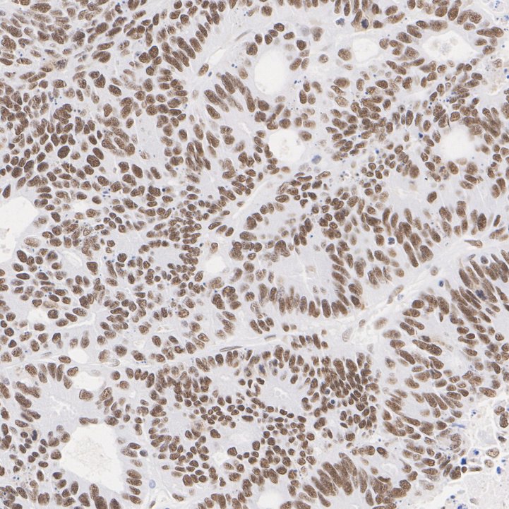 ADNP Recombinant Rabbit Monoclonal Antibody [PSH24-23]