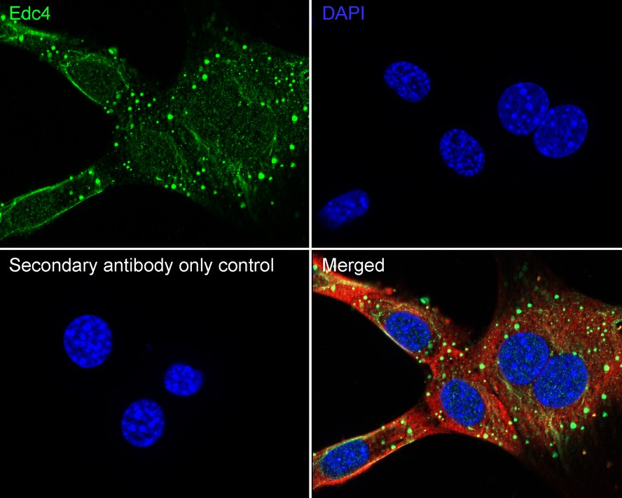EDC4 Recombinant Rabbit Monoclonal Antibody [PSH22-01]