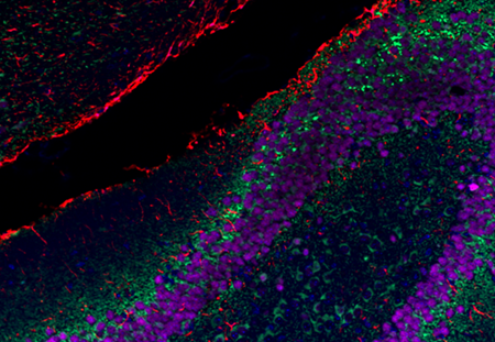 mouse_hipp_MAP2-gfAP-NeuN-ApoTome-44-20231227_c1-4(1).png