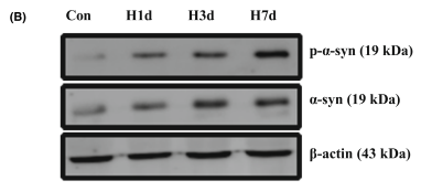 huabio_2642_202301310221315954.png