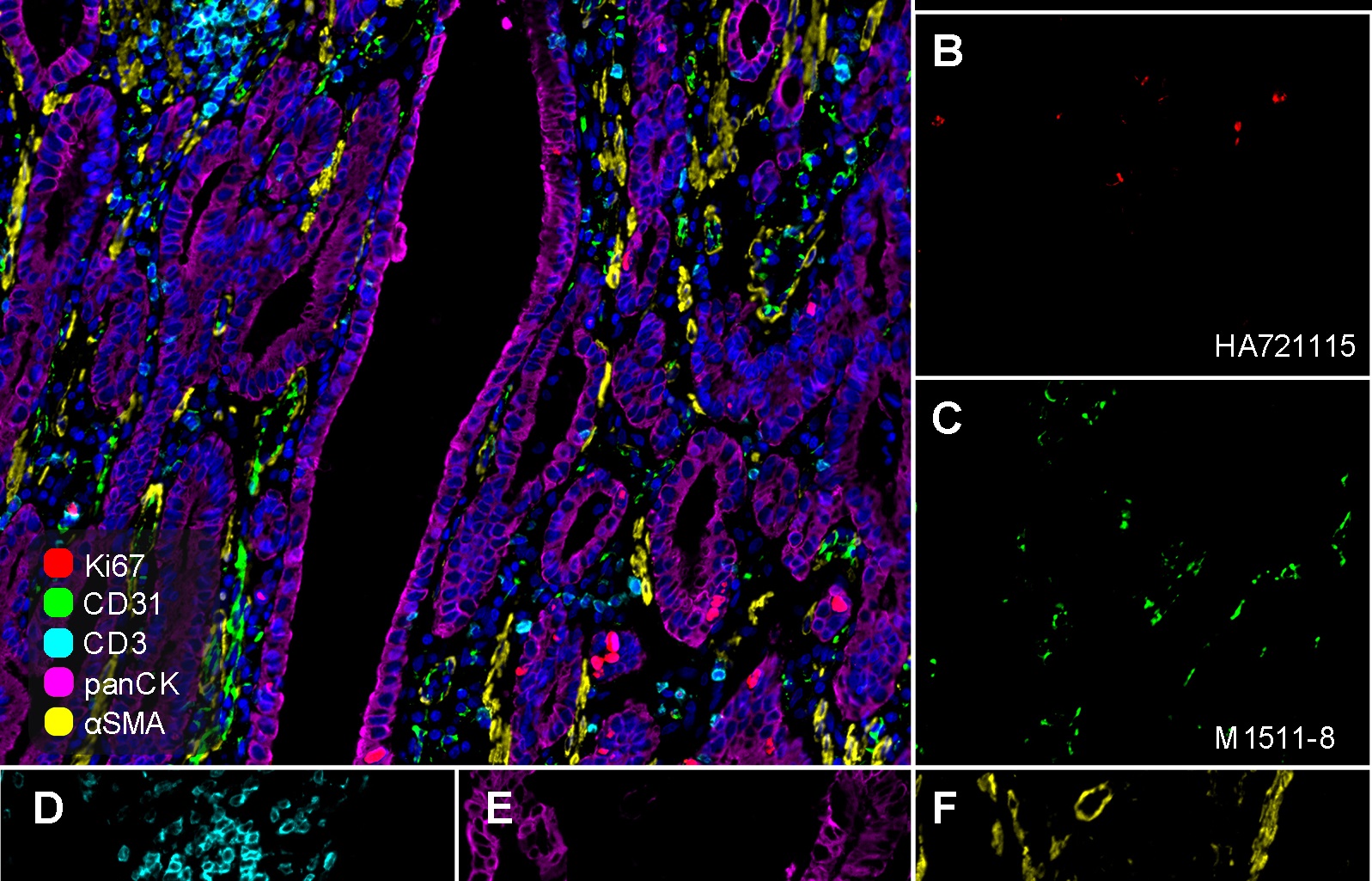 Small Size, Big Impact: Uncovering the Advantages of Nanobodies