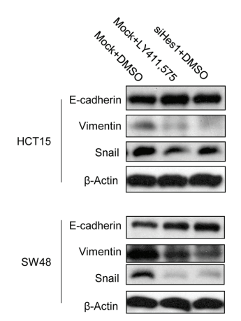 33371813-vimentin.png