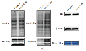 huabio_1650_202203110532315680.png