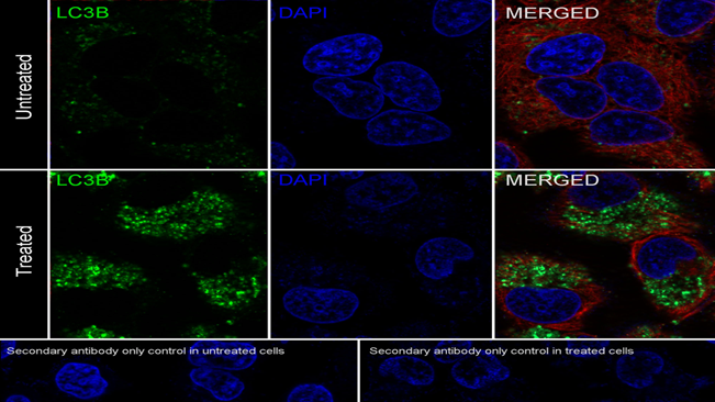 Immunocytochemistry analysis of HeLa cells.png