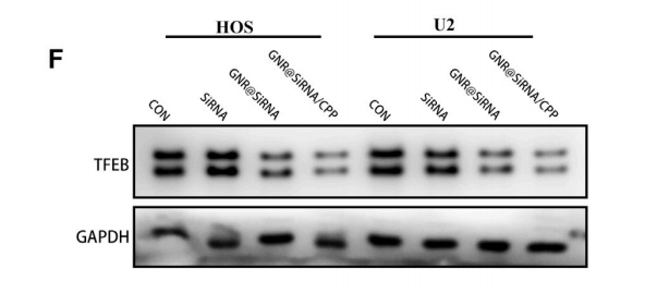 huabio_1535_202201110721233808.png