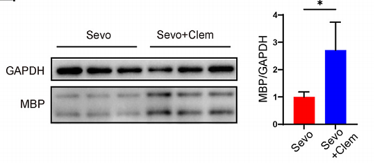 36495605 ET1601-4.png