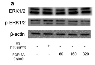 31289905 ET1601-29.png