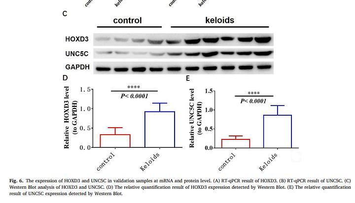 35709926 ET1601-4.jpg