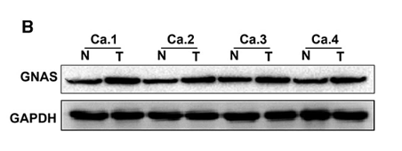 30767161 ET1601-4.png