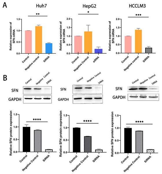 36996719 ET1601-4.jpg