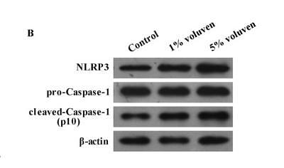 35413207 ET1702-67.jpg