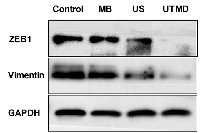 32313093 ET1601-4.png