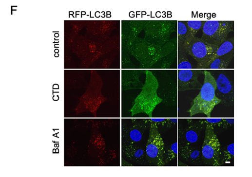 37060961 ET1701-65.png