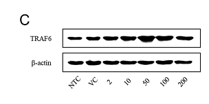 34704739 β-actin.png