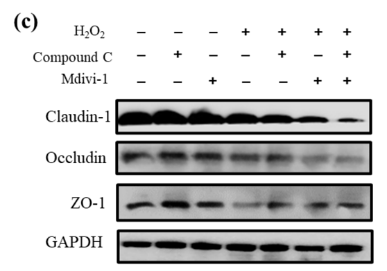 34943113 ET1701-76.png