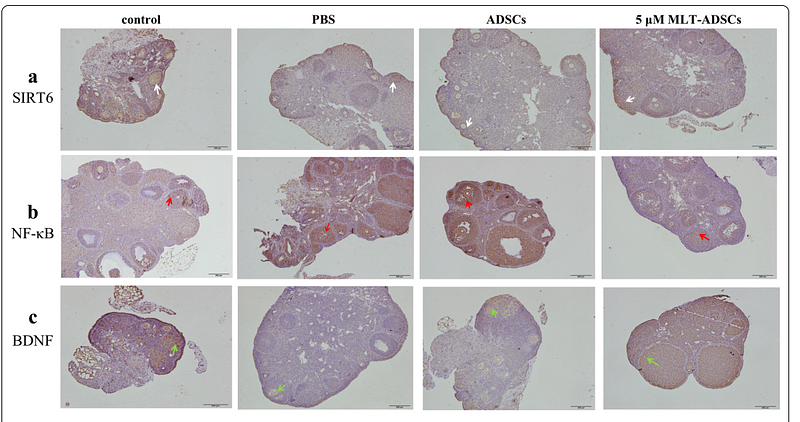 35927704 ET1606-42.png