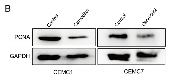 36495764 ET1601-4.png